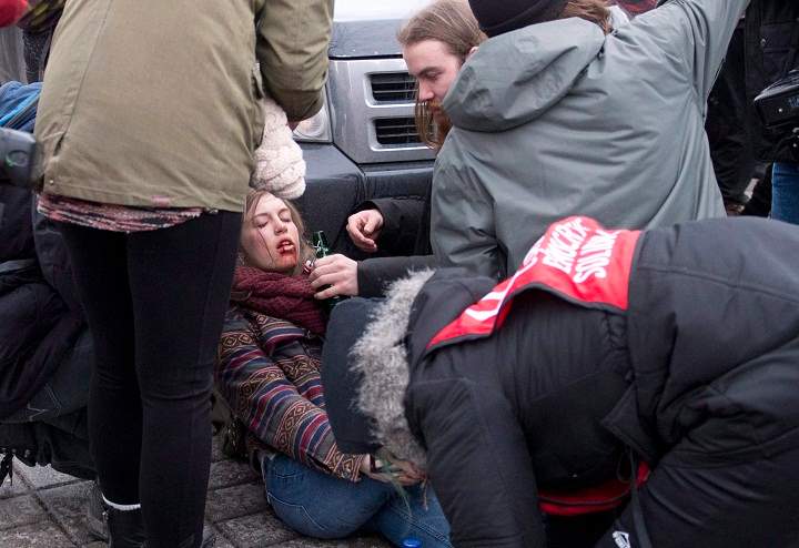 An injured woman is helped by demonstrators after tear gas was shot during an anti-austerity protest, Thursday, March 26, 2015 in front of the legislature in Quebec City.