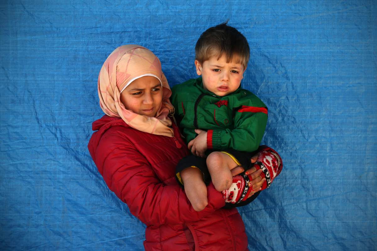 Fatemah Aldan holds her 2 year old brother, Saif, who lost both legs during a barrel bomb attack on their home town of Aleppo. Bashar al-Assad has been accused of barrel-bombing Syrian civilians.
