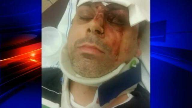 Sherman’s face bears the scars of his violent diabetic attack: a black eye, a broken nose, and some stitches above his brow.