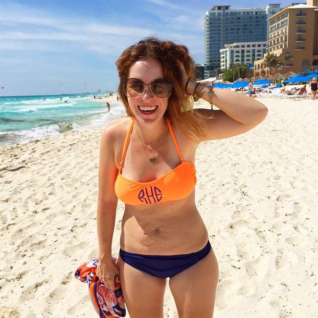 Love Your Lines stretch marks go viral in support of women