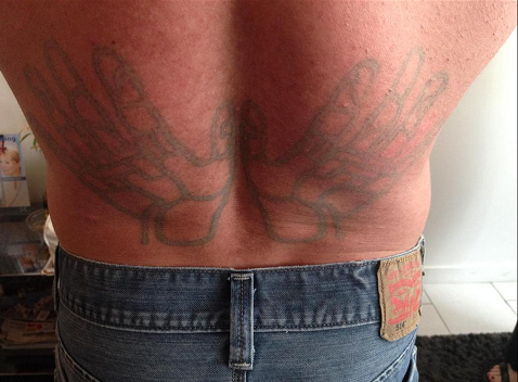 The dangers of do-it-yourself ‘stick and poke’ tattoos - image