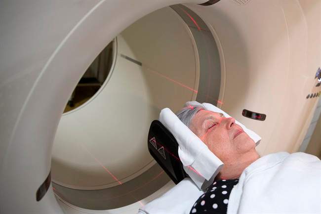 Study peeks into healthy brains to hunt Alzheimer’s culprit - image