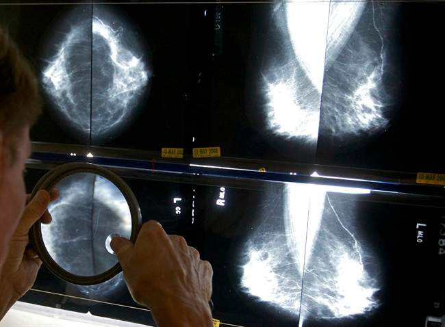 Thousands of breast cancer screenings in Hamilton and area skipped amid COVID pandemic - image