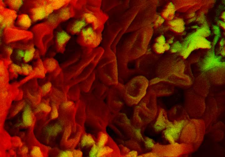 Using an electron microscope, scientists believe they've found blood cells in a 75-million-year-old dinosaur fossil.