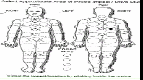 Taser Files: What we found in 594 pages of Taser incident reports - image