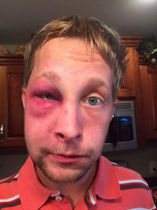 Mom’s heartbreaking message goes viral after son with Asperger’s assaulted - image