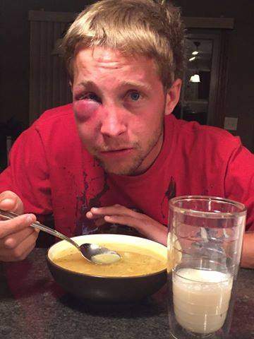 Mom’s heartbreaking message goes viral after son with Asperger’s assaulted - image