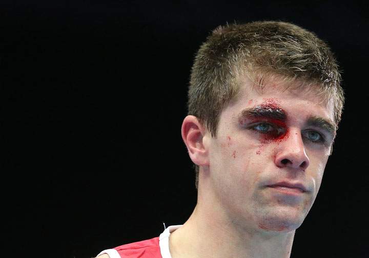 Canada's Brody Blair looks down after his fight against Zambia's Benny Muziyo was stopped due to injury following their men's boxing welterweight preliminaries round bout at the Commonwealth Games Glasgow 2014, Glasgow, Scotland, Monday, July 28, 2014.