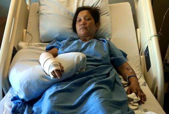 Mailane Bituin posted this photos on Facebook to document her recovery, Friday, July 24, 2015.