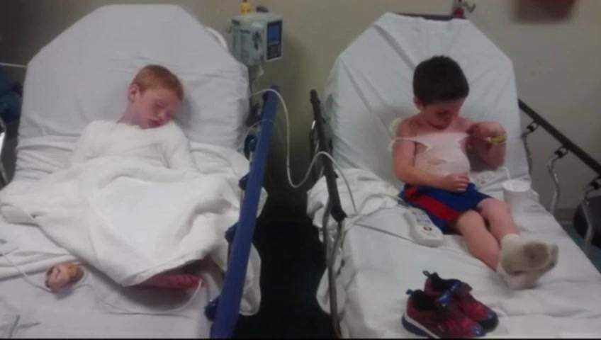 Boys who suffered horrific sunburns were in the sun less than 2 hours - image