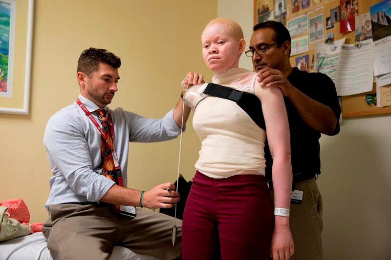 Lance Harms, left, and Luis Velasquez, fit Kabula Masanja, 17, for a prosthetic limb at the Shriners Hospital for Children in Philadelphia on Thursday, July 23, 2015.