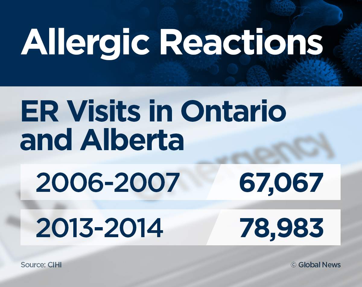 ‘It was terrifying’: ER visits for anaphylaxis up 95% in 7 years - image