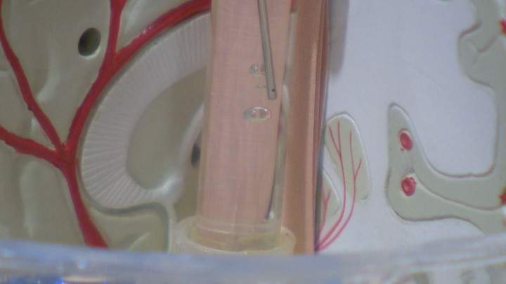 Groundbreaking research at U of S to use stem cells for brain repair - image