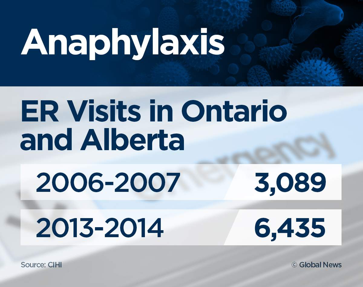 ‘It was terrifying’: ER visits for anaphylaxis up 95% in 7 years - image
