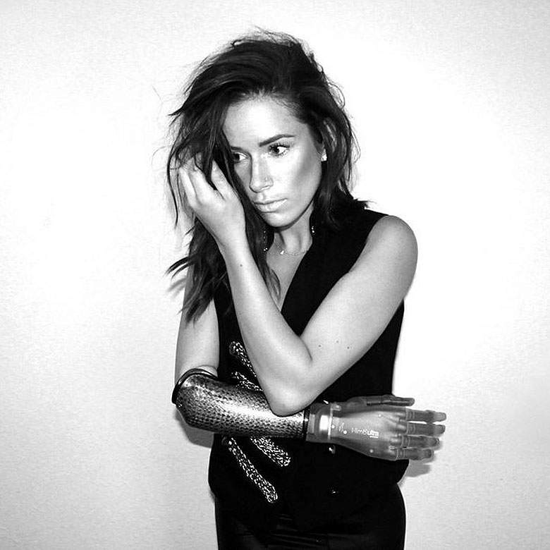 Meet the model with a bionic arm walking in New York Fashion Week - image