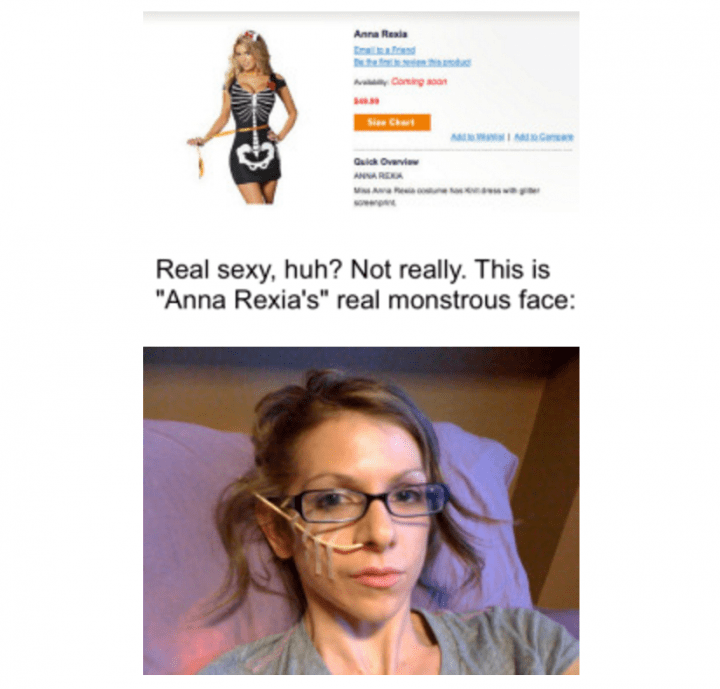Breakfast Buzz: Controversial ‘Anna Rexia’ costume - image
