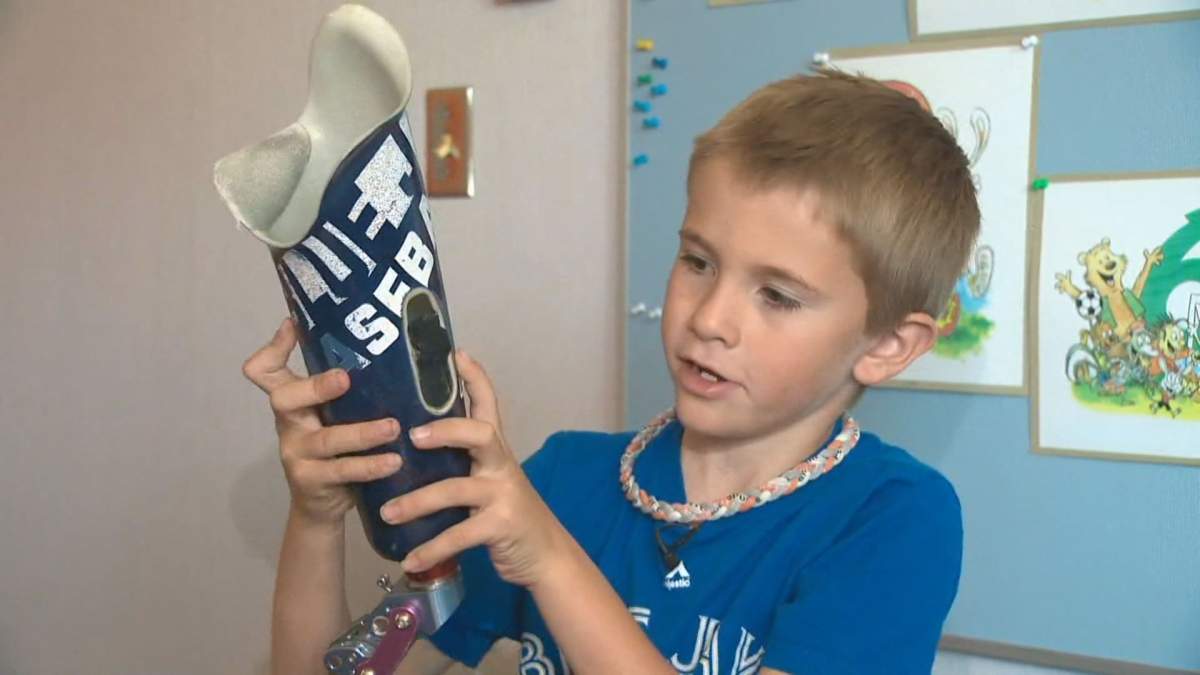 Roan Heck, who lives in Stettler, Alta., shows us his prosthetic leg that’s signed by the Blue Jays.