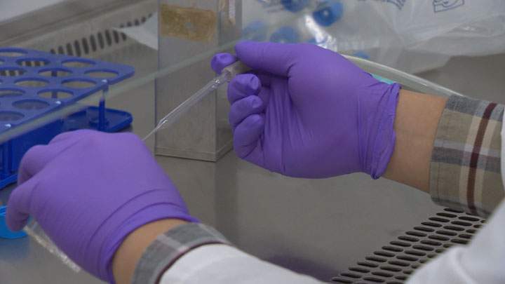 Researchers in Saskatchewan hope a simple blood test will help detect a concussion sooner.