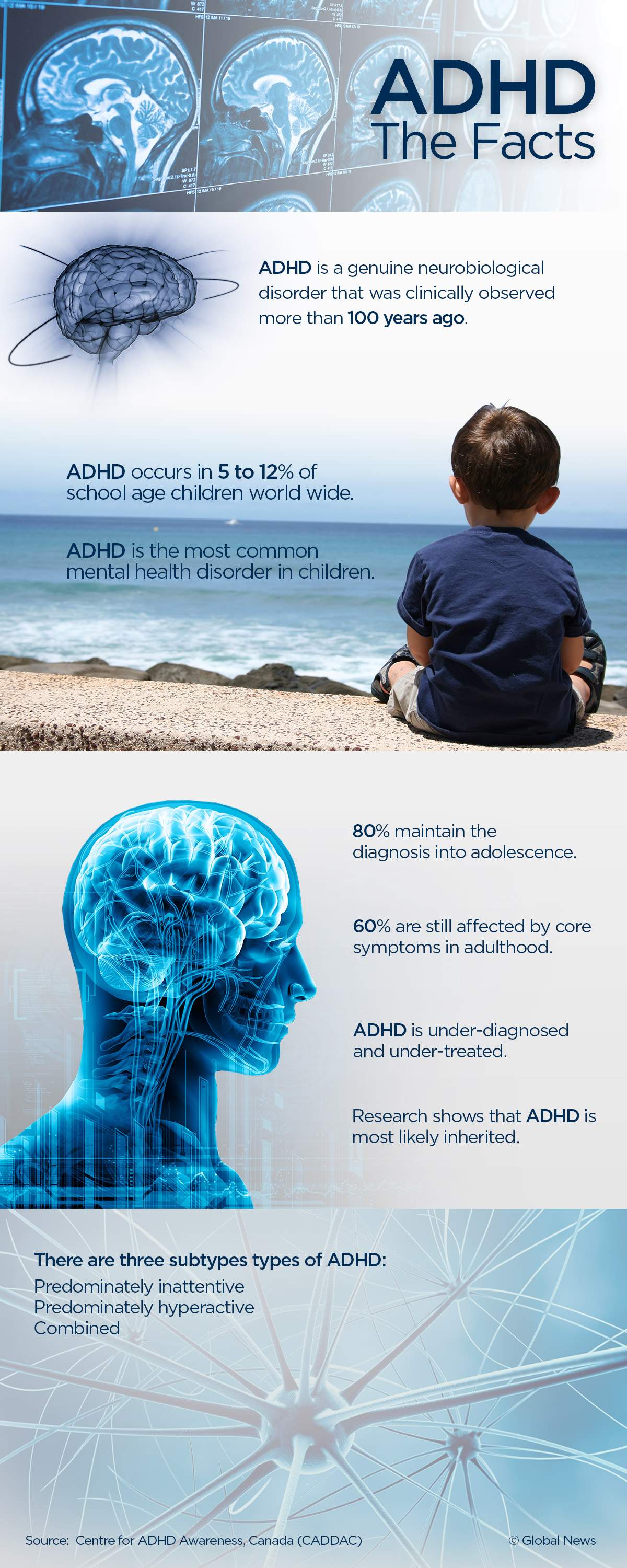 43% increase in ADHD diagnosis in U.S. children and teenagers - image