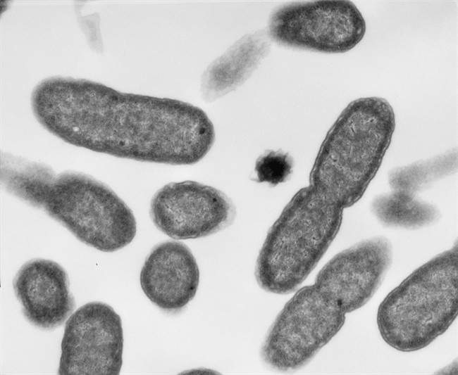 Cobourg's West Harbour is closed for swimming due to high levels of E. coli bacteria.