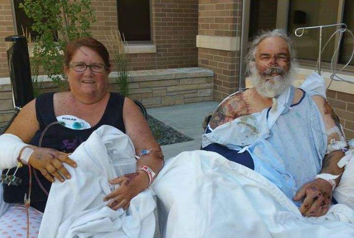 Jeri and Jeff Hamilton after their August 2015 motorcycle crash.