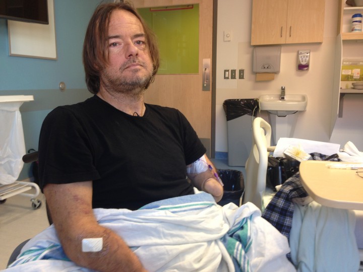 Richard Lemieux received life-saving treatment at the MUHC after Global News covered his story, Monday, January 25, 2016.