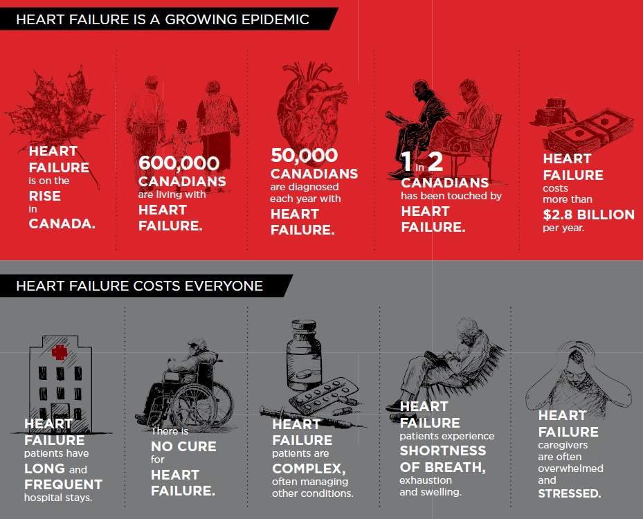 Heart failure rates rising in Canada: Heart and Stroke Foundation - image