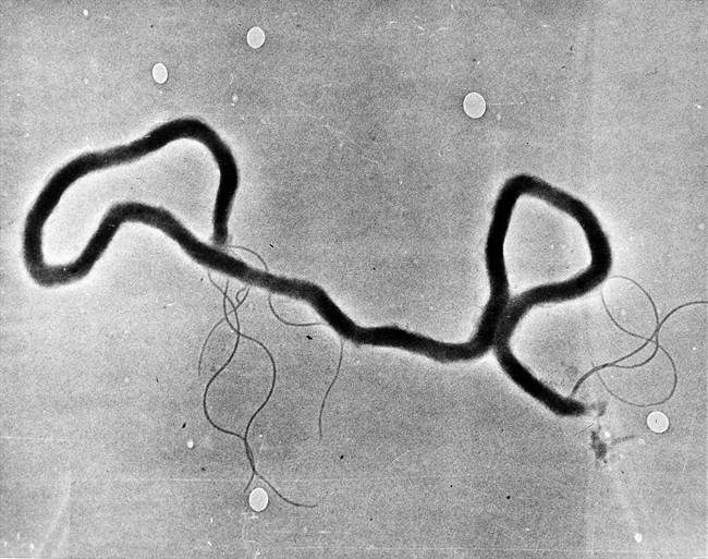 In this 1944 file photo, the organism treponema pallidum, which causes syphilis, is seen through an electron microscope. Syphilis rates in Alberta more than doubled in a year.