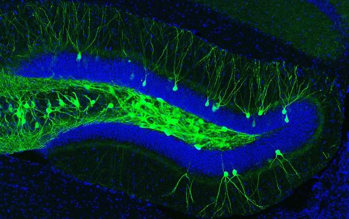 In this image of a mouse model of early Alzheimer’s disease, engram cells (green) that encode a fear memory were tagged with a light-sensitive protein.