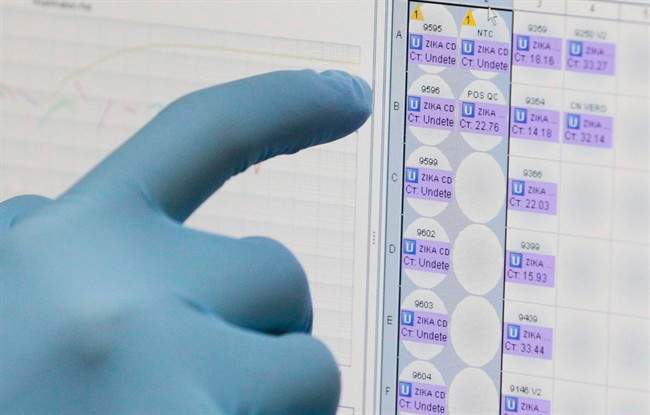FILE - In this Thursday, Feb. 4, 2016, file photo, a medical researcher uses a monitor that shows the results of blood tests for various diseases, including Zika, at the Gorgas Memorial laboratory in Panama City. 