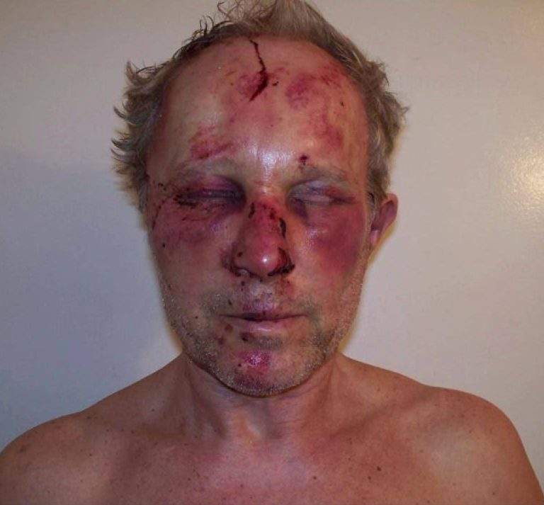 Vancouver man levels allegations of police brutality against VPD - image
