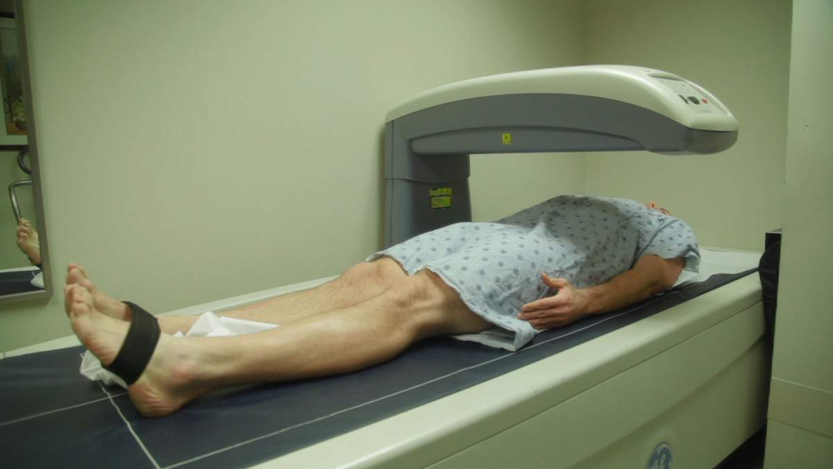 Sleep-deprived Canadians risking serious long-term health problems: scientists - image
