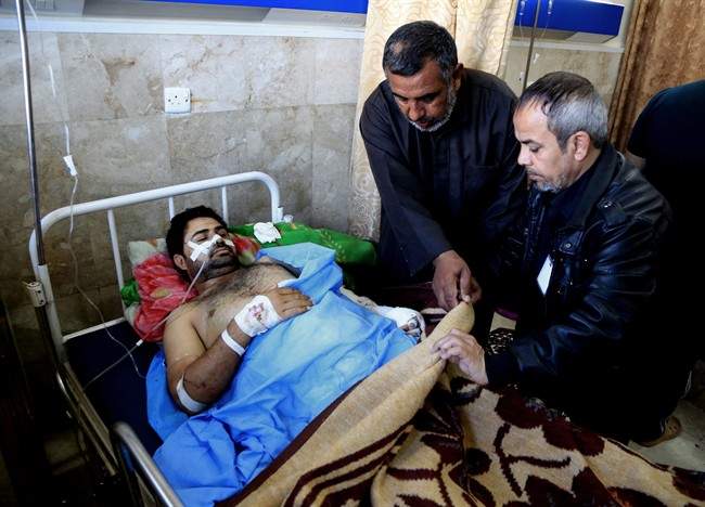 An injured victim of bombing attacks receives treatment at the Imam Ali Hospital in Sadr City, Baghdad, Iraq on Monday, Feb. 29, 2016. 