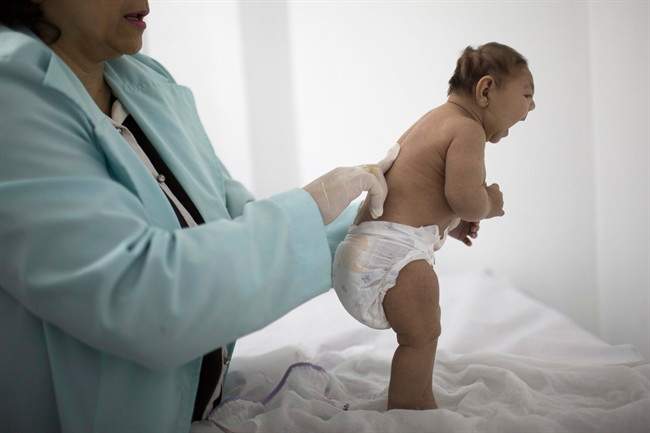 Zika virus update: Canadian cases amp; what to do to prevent it - image