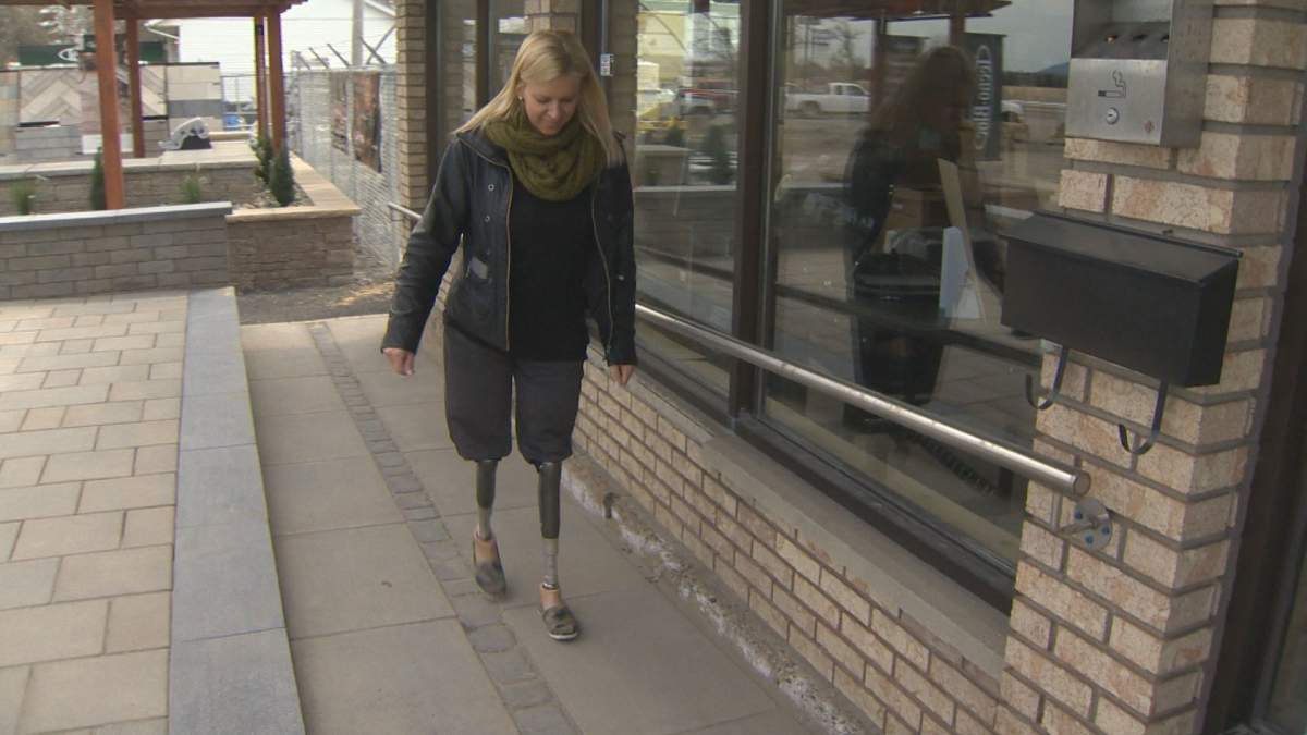 Kathy Wilcheck walks on prosthetic limbs after losing her legs to flesh-eating disease, Tuesday, April 26, 2016.