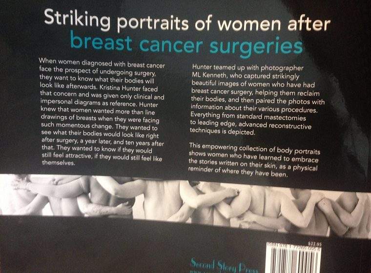 ‘There is nothing like this out there’: breast cancer survivor on book she hopes will help others - image