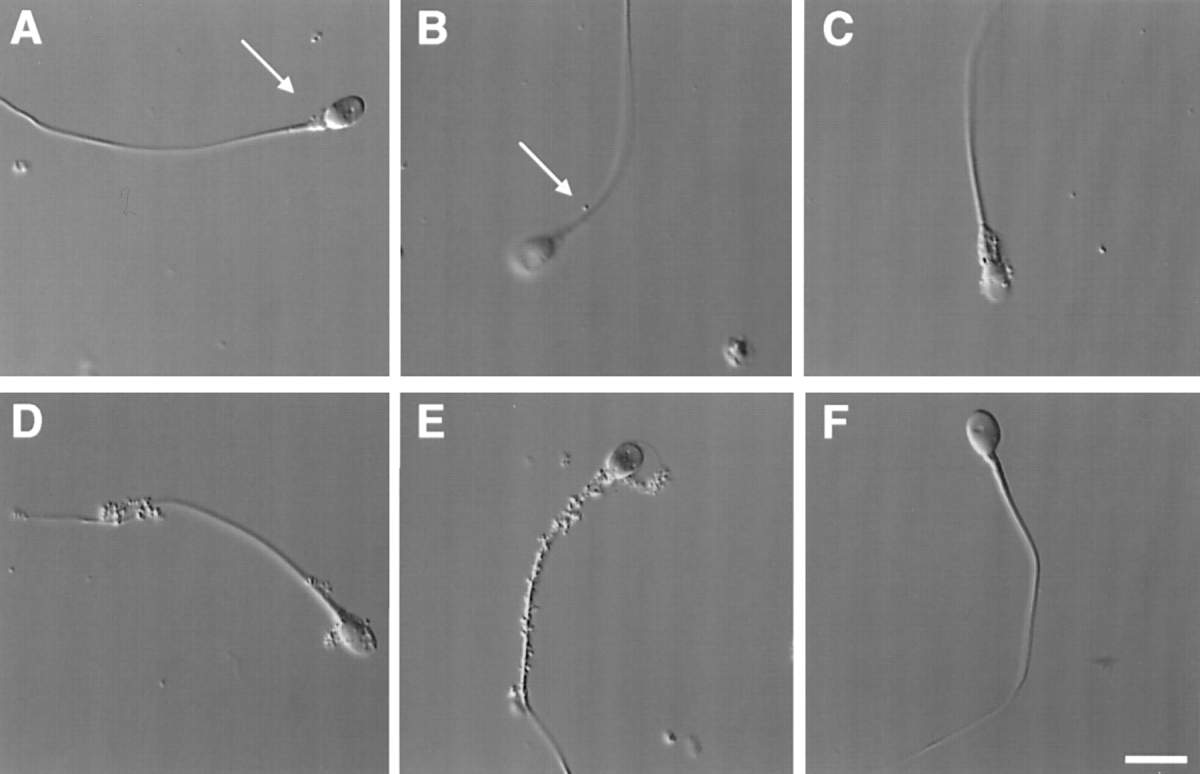 Nomarski microscopy image of sperm incubated in vitro with Mycoplasma genitalium.