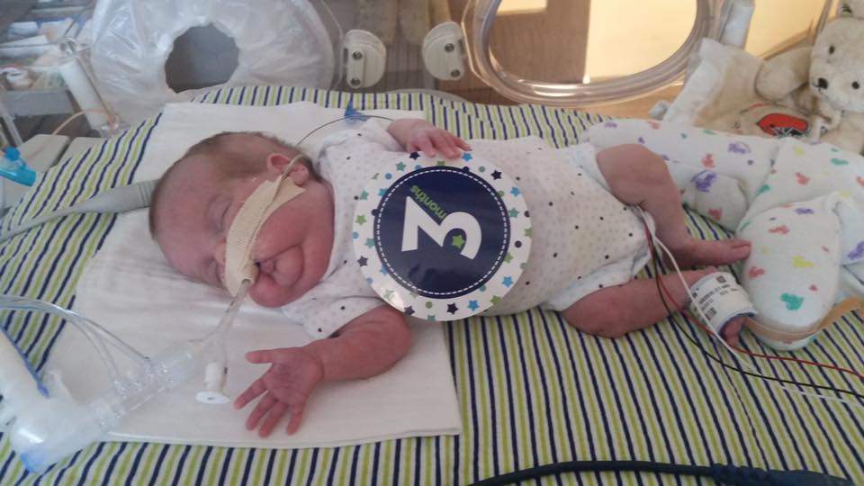 Inside a NICU: a ‘tough world people are totally unaware of’ - image