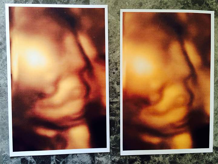 Jenn Cusimano claims the photo she received from BabyView 3D Prenatal Imaging (right) is identical to an ultrasound image another mother received (left) from the same clinic.