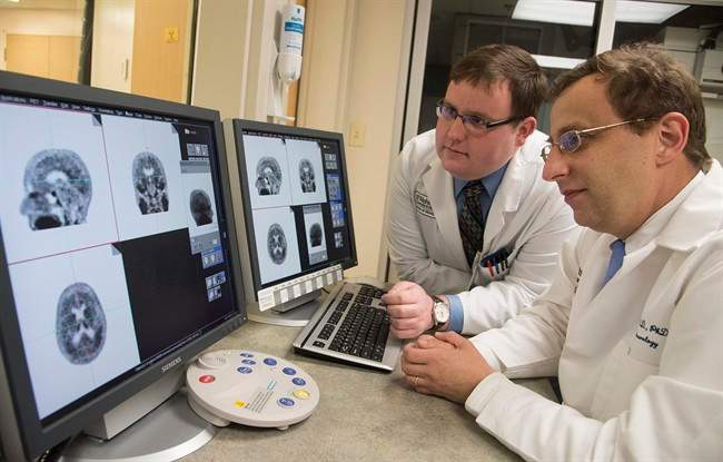 New study locates genes affecting depression risk - image