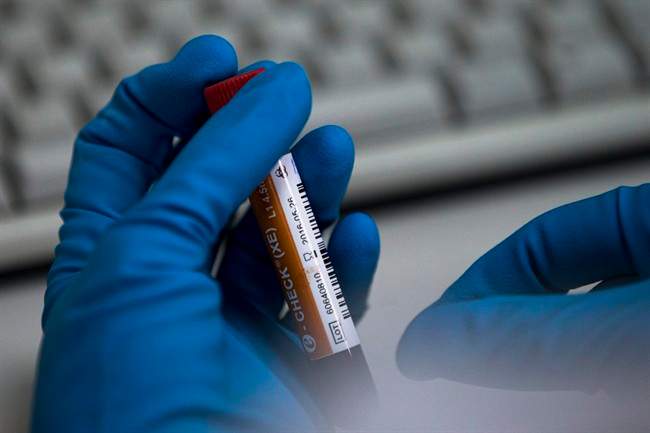 An employee of the Russia's national drug-testing laboratory holds a vial in Moscow, Russia, Tuesday, May 24, 2016. 
