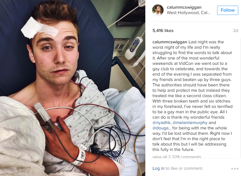 YouTube star Calum McSwiggan injured himself, falsely claimed to be victim of anti-gay hate crime: police - image