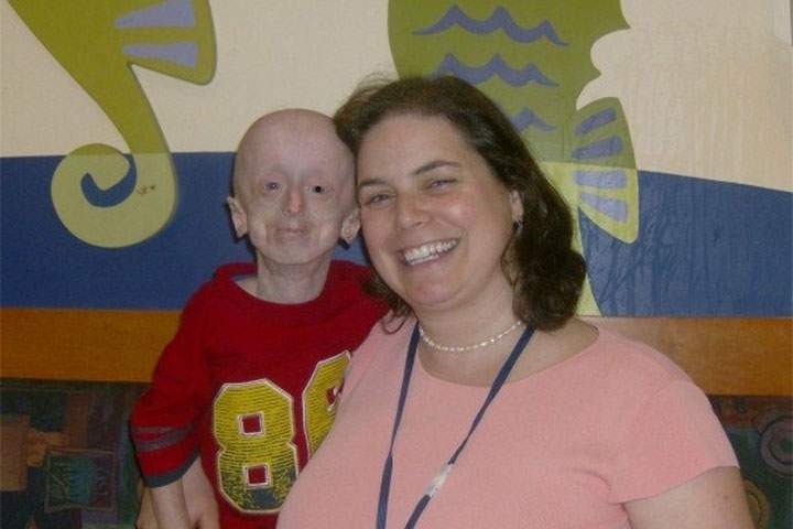 Hamilton teen with rare aging disorder vows to ‘keep fighting’ - image
