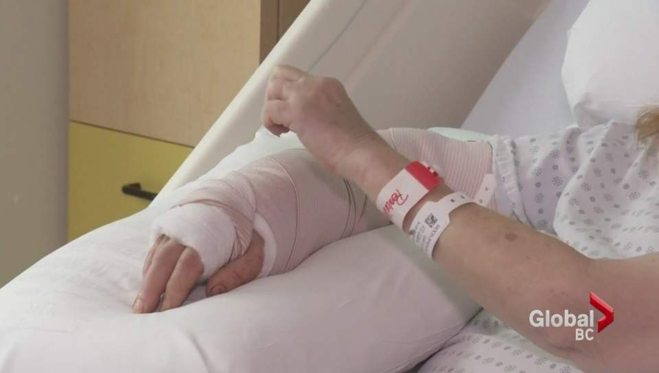 Pit bull that attacked woman in Surrey killed by Animal Control - image