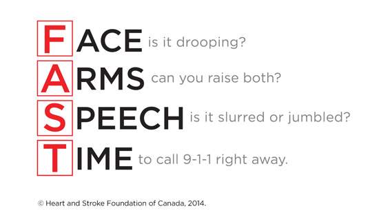 Saskatoon woman warning others about uncommon signs of a stroke - image