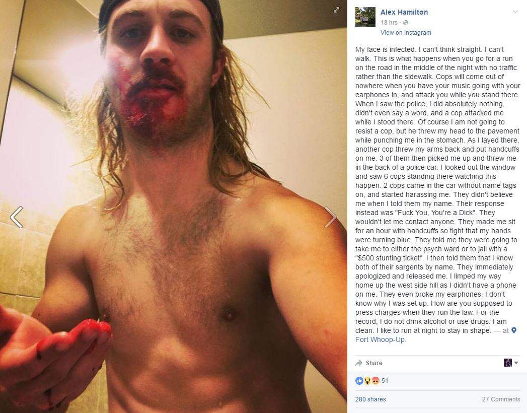 Lethbridge Police launch an investigation after a post to social media accuse their officers of police misconduct.