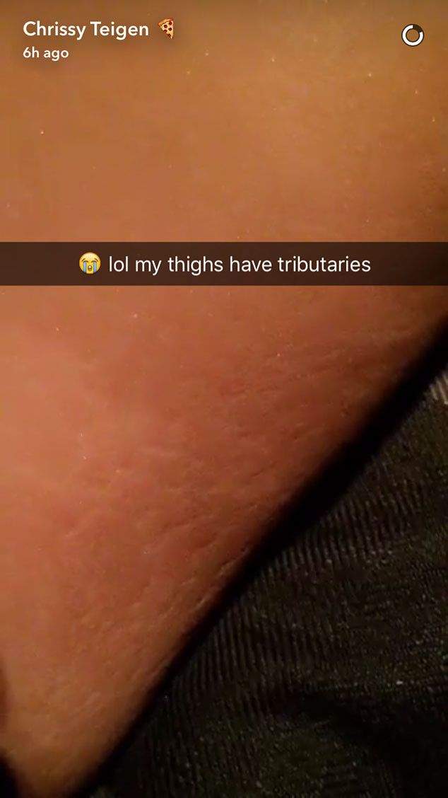Chrissy Teigen owns her post-baby body and stretch marks - image