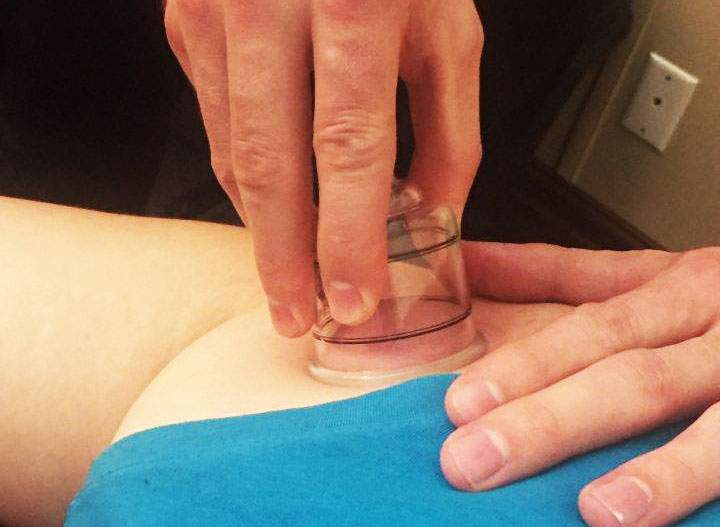 Michael Phelps sparks cupping craze, do you know what it is? - image