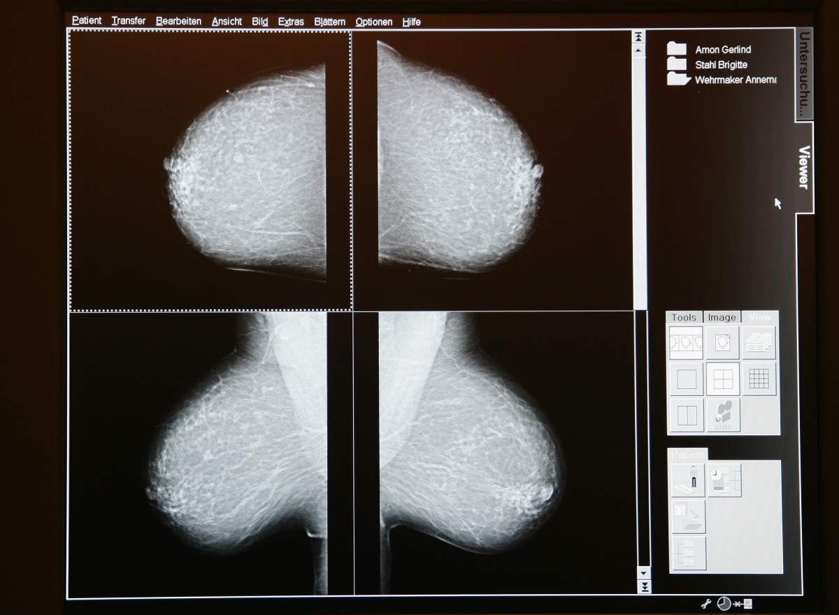 A digital image is seen at the mammamobil on April 8, 2008 in Berlin, Germany. 