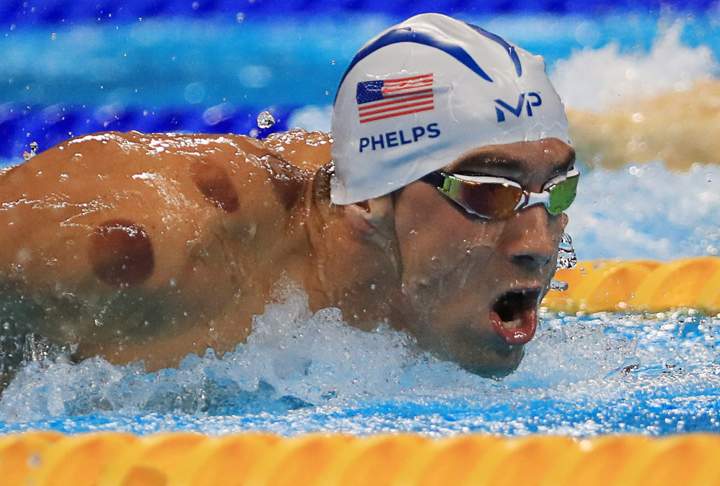 Michael Phelps sparks cupping craze, do you know what it is? - image